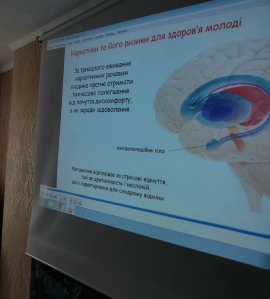 Зображення недоступне